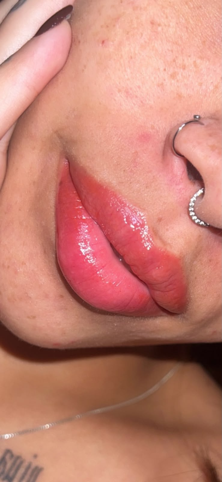 Resultado de micropigmentação labial